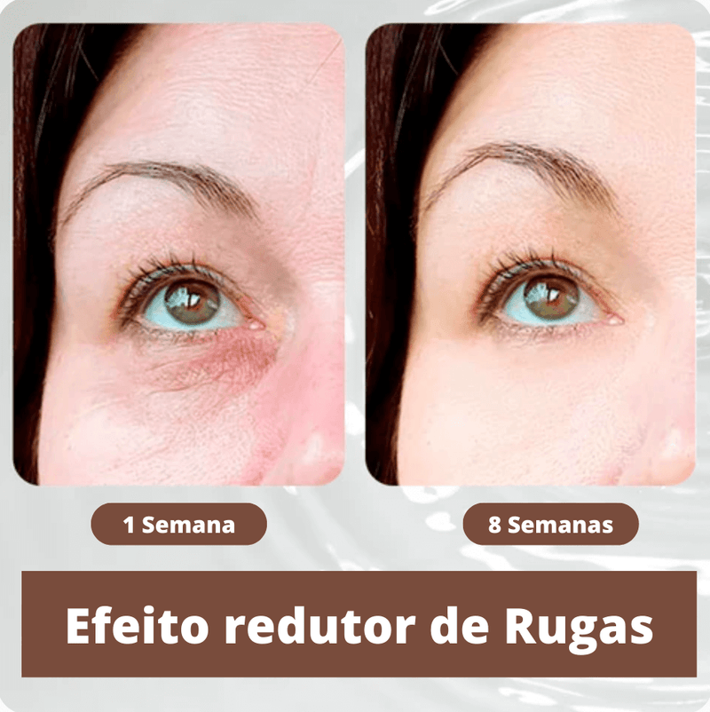 Gel Antienvelhecimento Openeyes Efeito Prolongado