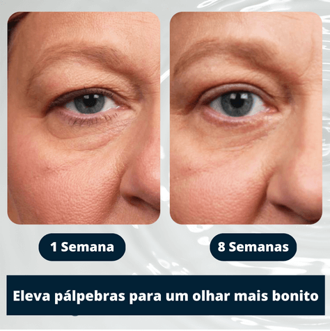 Gel Antienvelhecimento Openeyes Efeito Prolongado