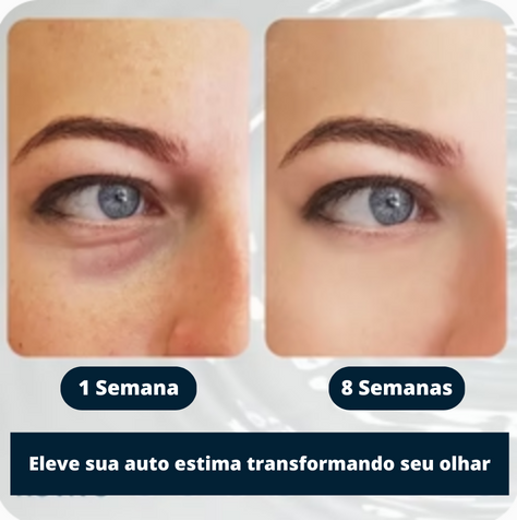 Gel Antienvelhecimento Openeyes Efeito Prolongado